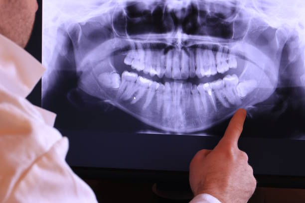 Best Cosmetic Emergency Dentistry in East Dubuque, IL