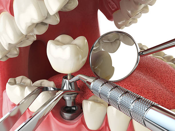 Best Pediatric Emergency Dentist in East Dubuque, IL
