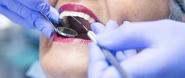 Best Emergency Treatment for Dental Infections or Abscesses in East Dubuque, IL